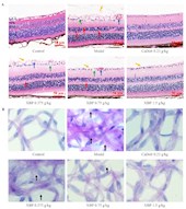 孟宪丽教授团队在Journal of Ethnopharmacology期刊发表藏药小檗皮改善糖尿病视网膜疾病新机制的研究成果
